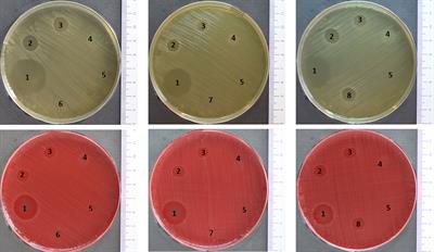 Antimicrobial Mechanisms of Leucocyte- and Platelet Rich Fibrin Exudate Against Planktonic Porphyromonas gingivalis and Within Multi-Species Biofilm: A Pilot Study